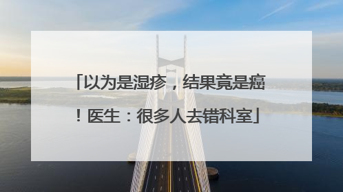 以为是湿疹，结果竟是癌！医生：很多人去错科室